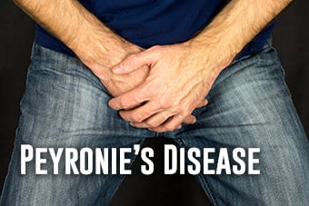 5 Ways Peyronie's Disease Can Affect Your Sex Life - Z Urology