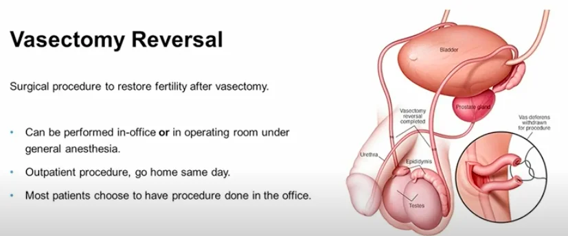 True Relationships & Reproductive Health - Is recovery from a Vasectomy  long and painful? Most patients are fully recovered from their vasectomy  within a week, are back at work and also back