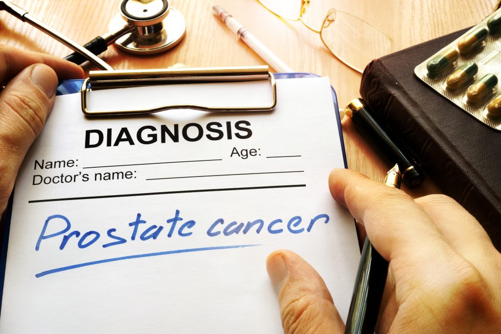 What To Do When Youre Diagnosed With Prostate Cancer Z Urology 4443