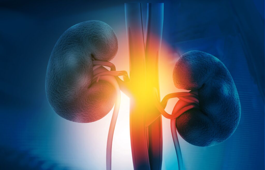 What Causes A Person To Keep Getting Kidney Stones