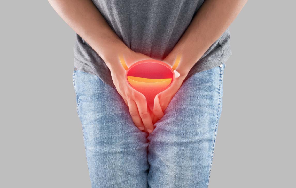 https://zurology.com/wp-content/uploads/2023/07/Urinary-Bladder-Cancer-01.jpg