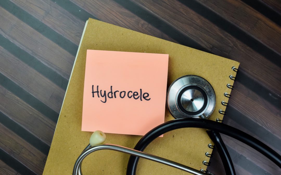 Understanding Hydrocele: Comprehensive Care at Z Urology