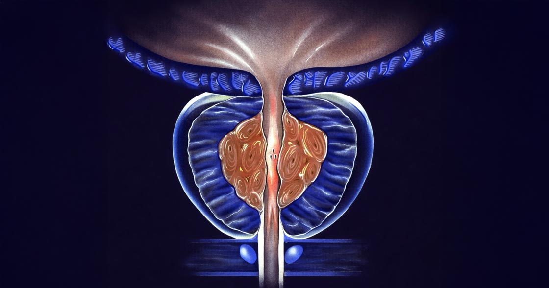 drawing of a prostate gland